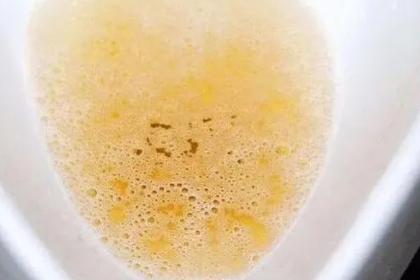 人粪尿属于哪种肥料,是一种富含养分的有机肥