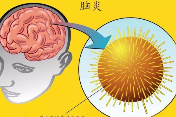 狂犬病能检查出来吗，狂犬病能检查出来