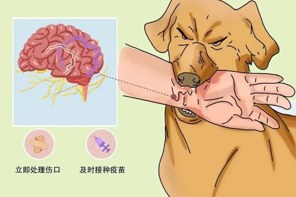 狂犬病能检查出来吗，狂犬病能检查出来