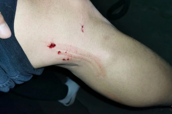 狂犬病能检查出来吗，狂犬病能检查出来