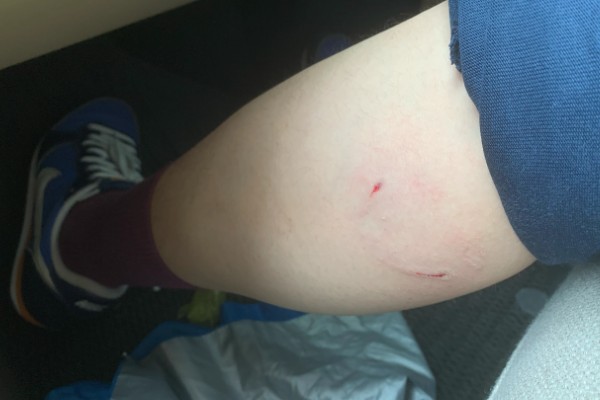 狂犬病能检查出来吗，狂犬病能检查出来