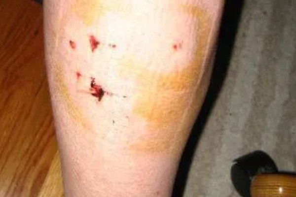 狂犬病能检查出来吗，狂犬病能检查出来